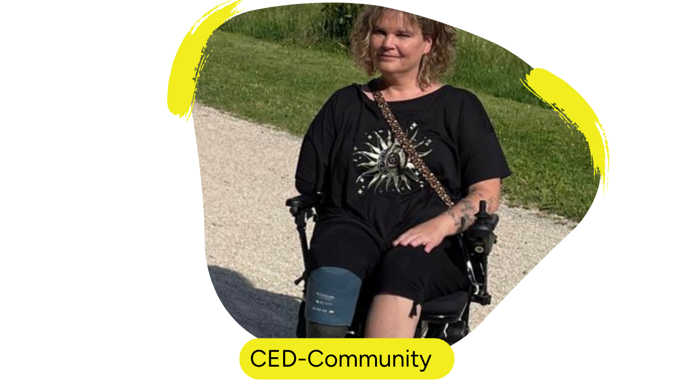Das Bild zeigt Conny, Conny ist eine Content-Creatorin, die sich für das Thema Sepsis bei CED stark macht. Sie trägt auf dem Bild ein schwarzes T-shirt und eine Jeanshose. Sie sitzt im Rollstuhl und befindet sich im Hintergrund auf einem geschotterten Weg, vermutlich ein Feldweg und lächelt in die Kamera. Der Beitrag in dem das Bild verwendet wird erzählt die Geschichte von Conny.