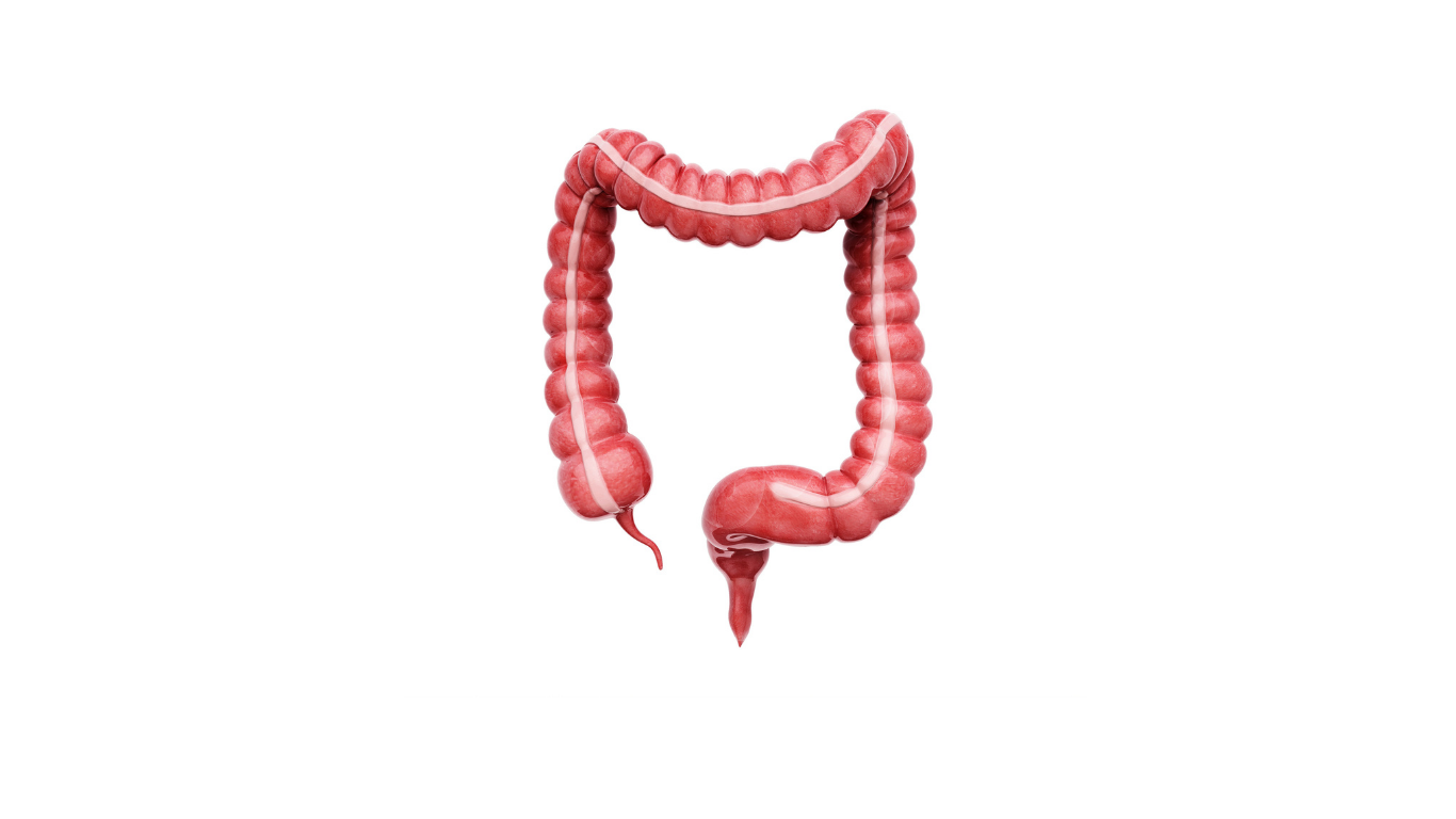 Das Bild zeigt den Dickdarm. Es steht symbolisch für CED-Erkrankungen wie Colitis ulcerosa und Operationen die bei dieser Erkranung gemacht werden müssen